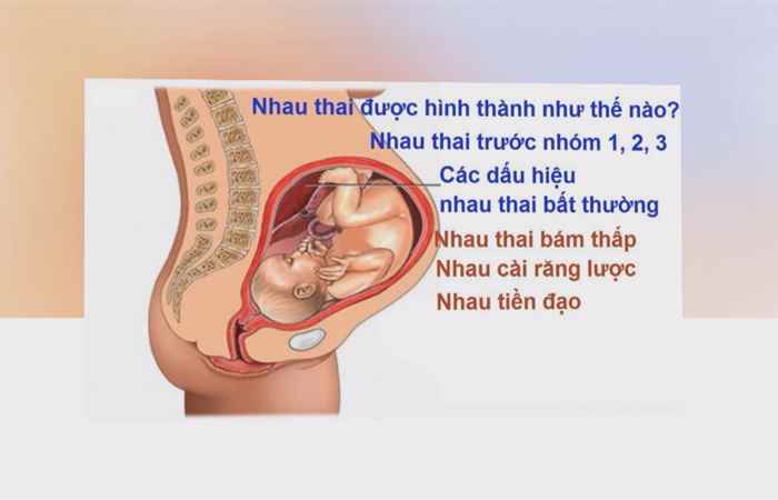 Sống khỏe 360 -  Thế nào là hiện tượng nhau bám thấp (23-02-2020)